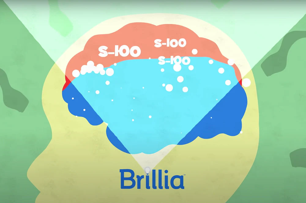 Clarity for Every Mind